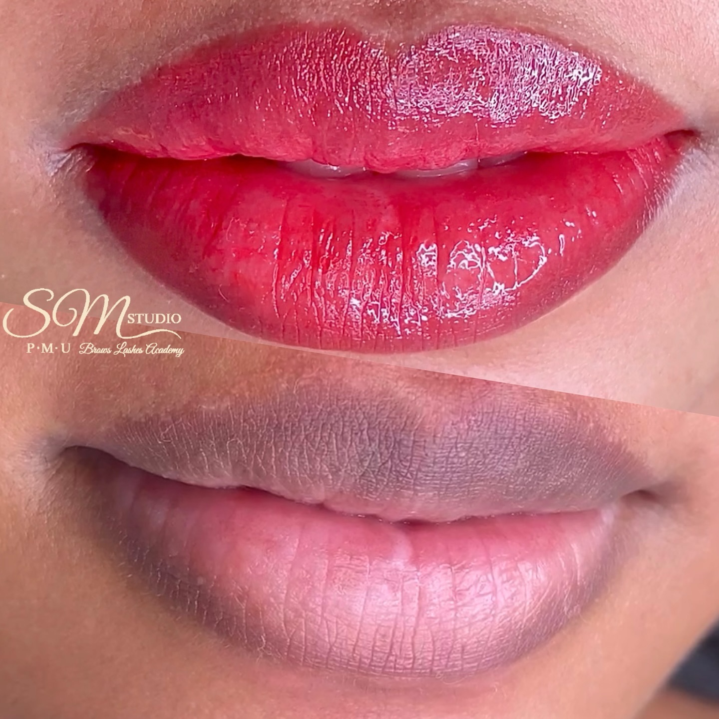 SM Lips